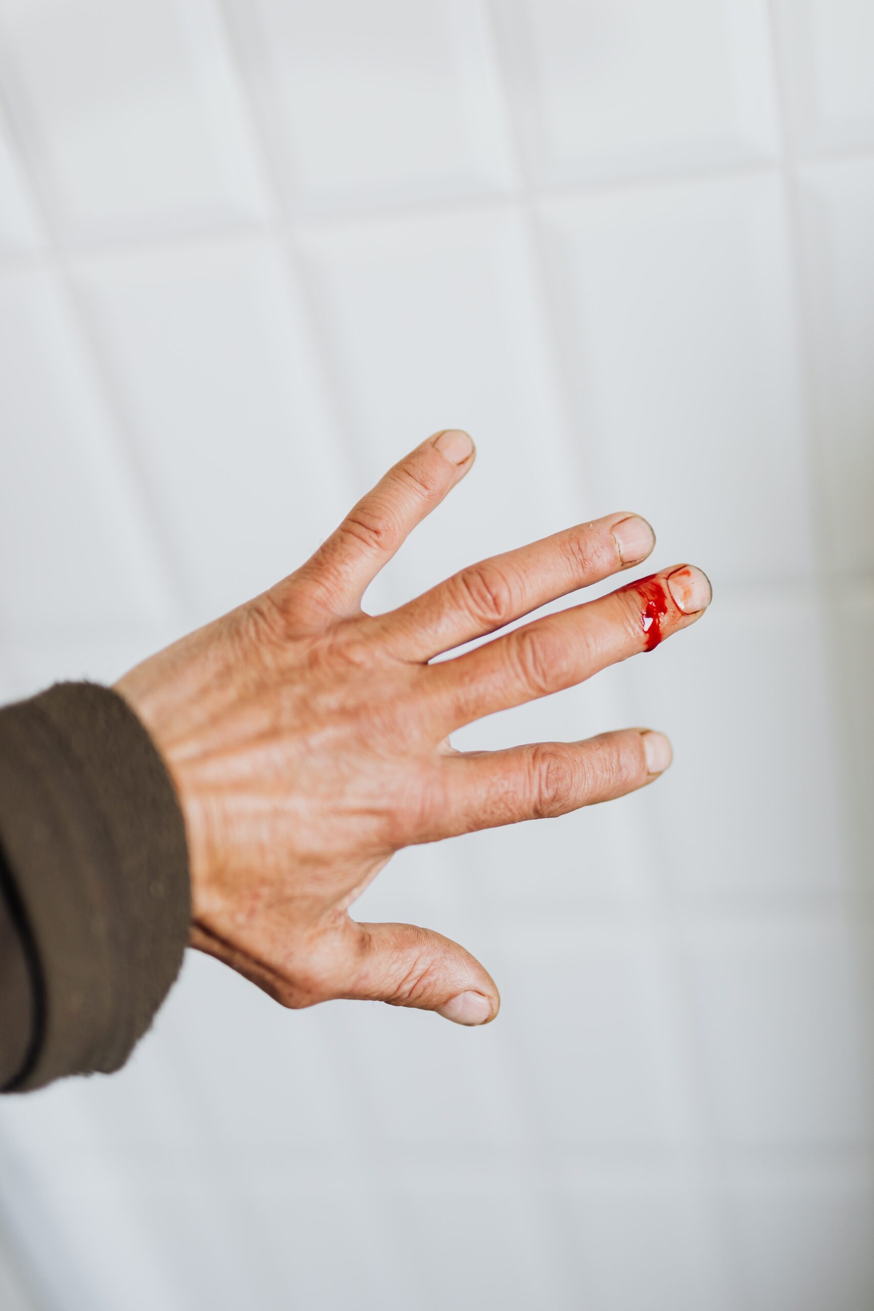 blood spots on carpet from cut finger